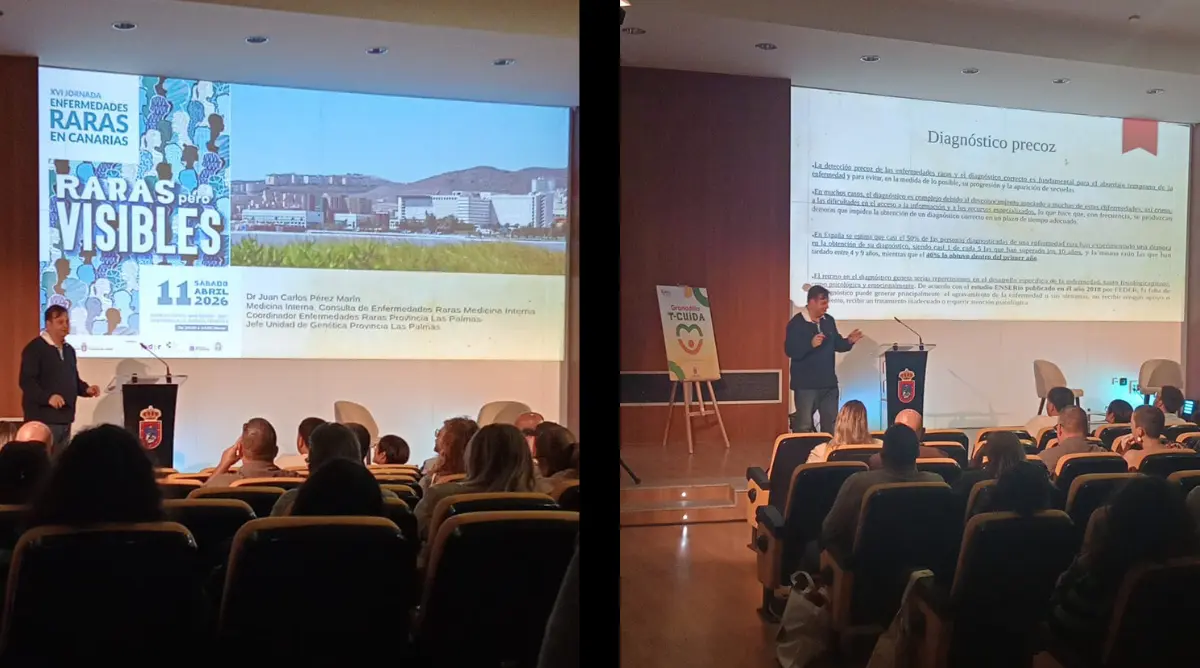 Jornadas sobre enfermedades raras en Granadilla de Abona Tenerife, importancia del diagnóstico precoz